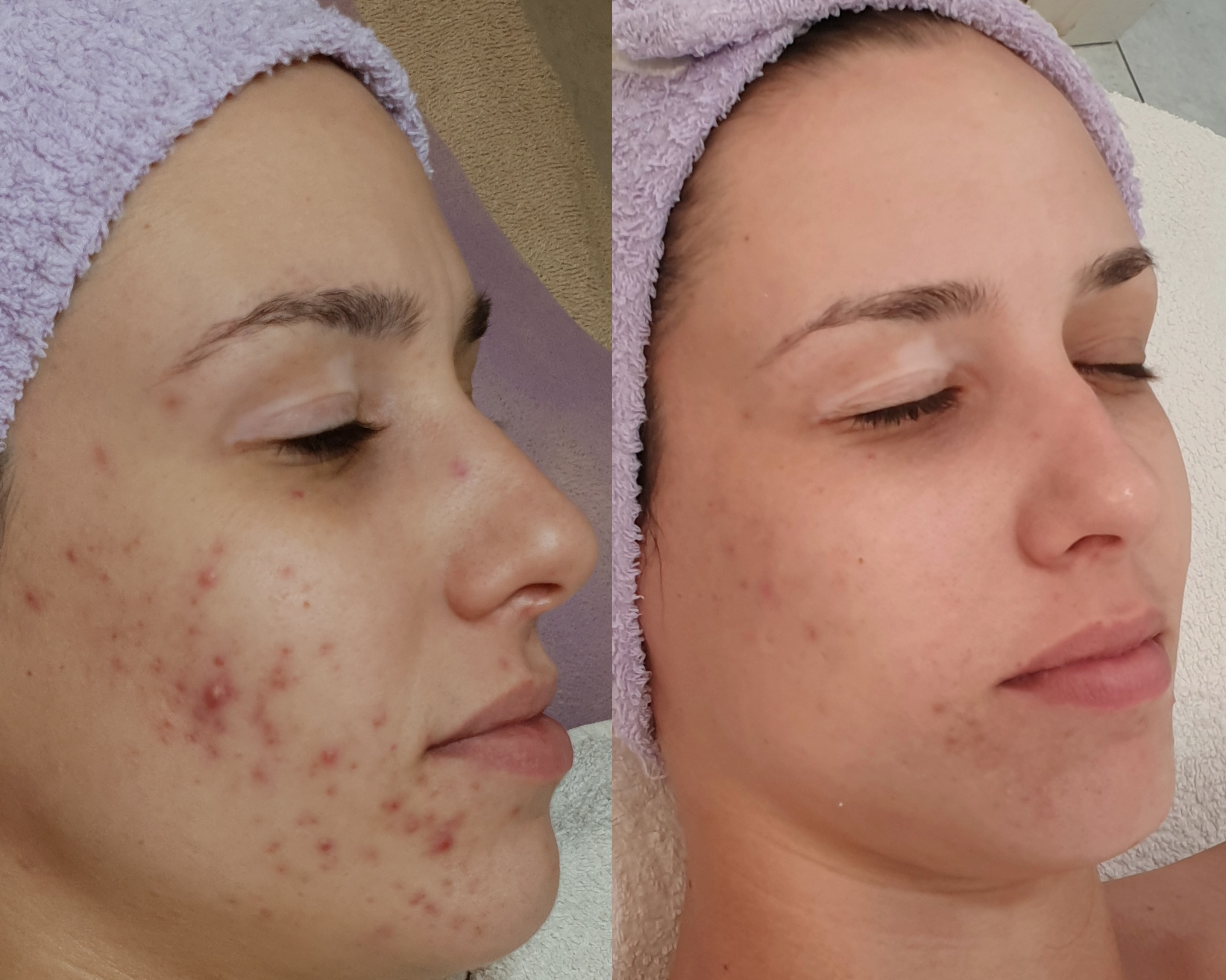 before and after results of applying makeup at Mali Salon